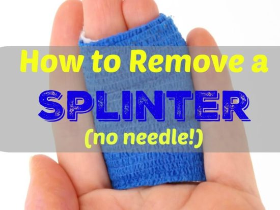 How to Remove a Splinter without a Needle | Healthy Home Economist