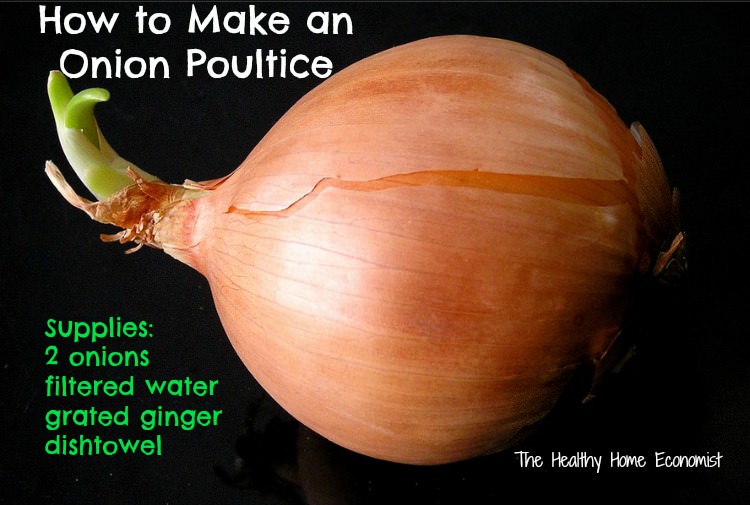 How to Make and Use an Onion Poultice for Congestion Healthy Home
